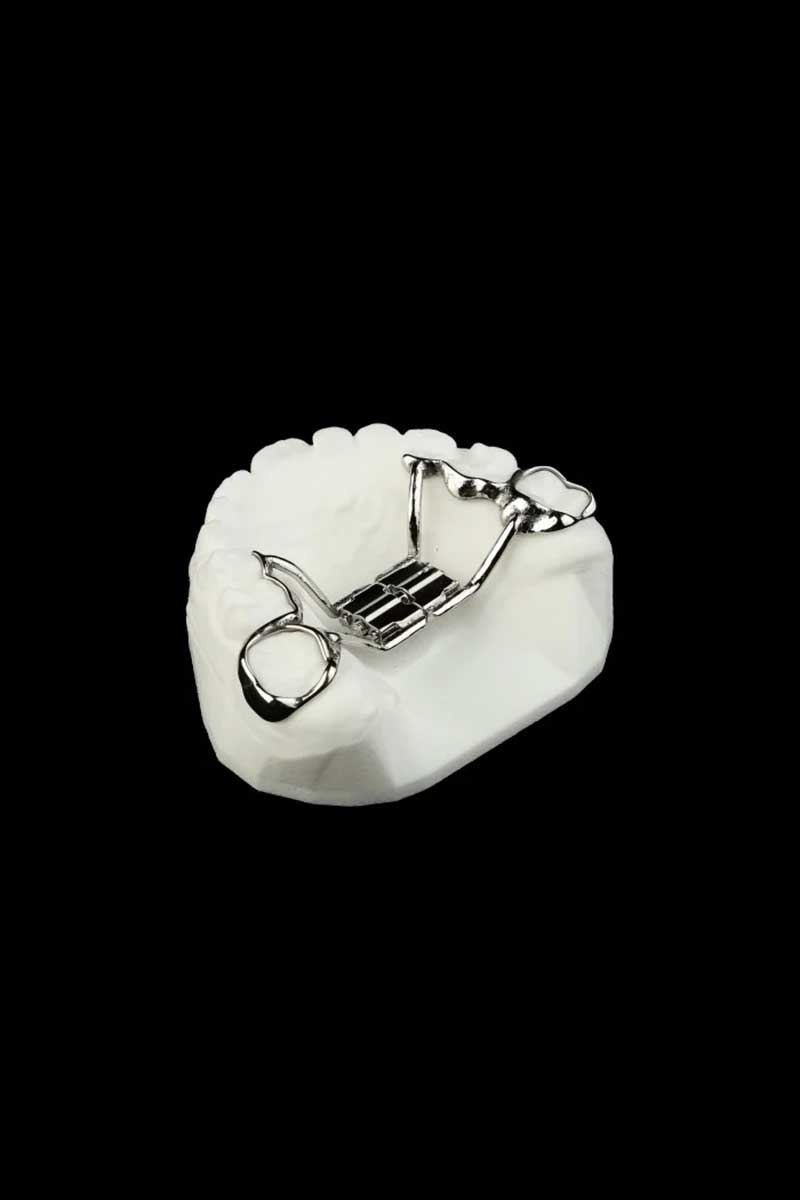 Palate expander Prosper tx