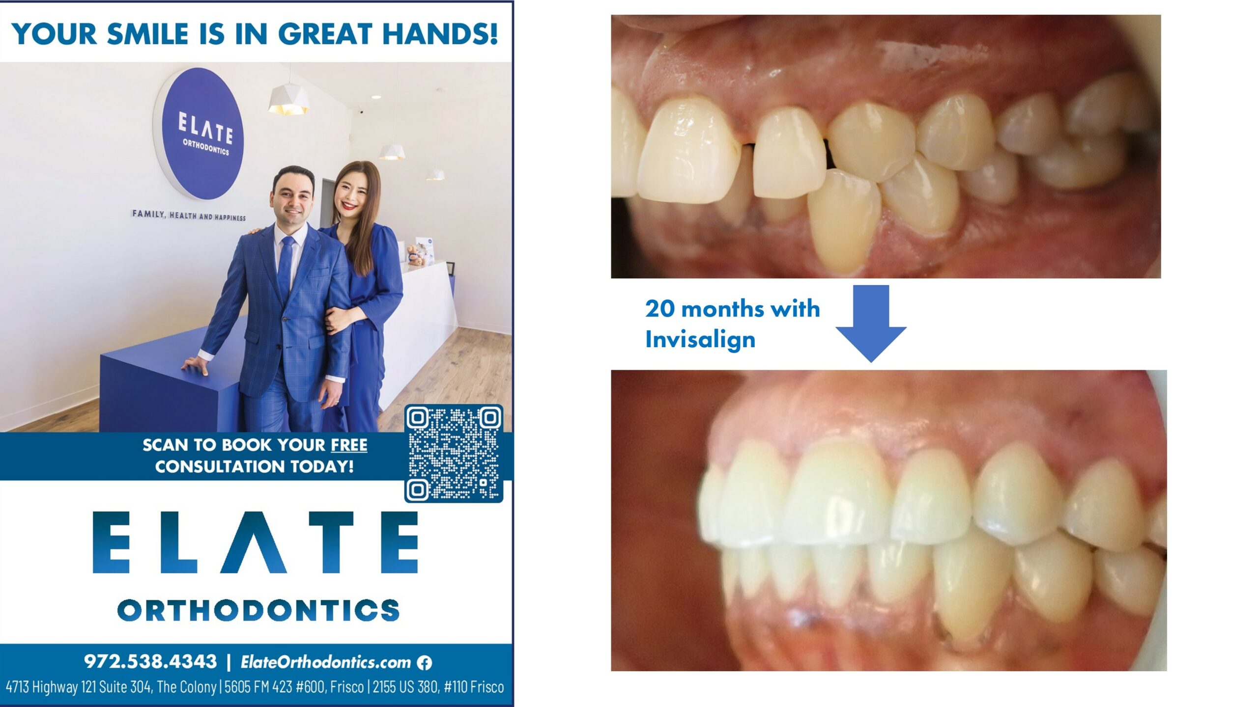 Orthodontist in Aubrey, TX – Braces & Invisalign at Hollyhock

