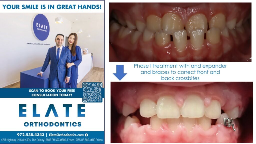 Phase I Treatment Before and After