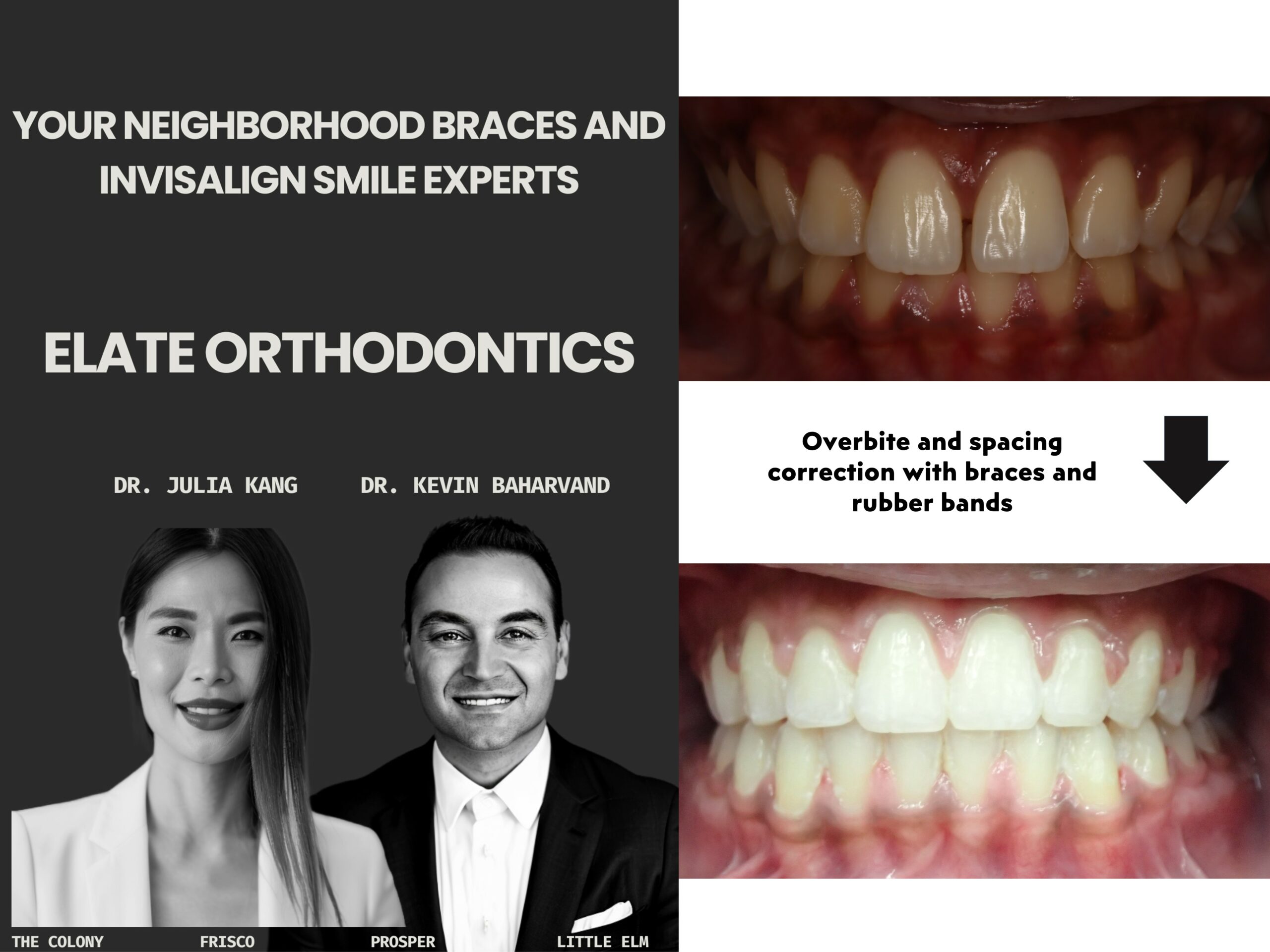 Orthodontist Near Lewisville, TX