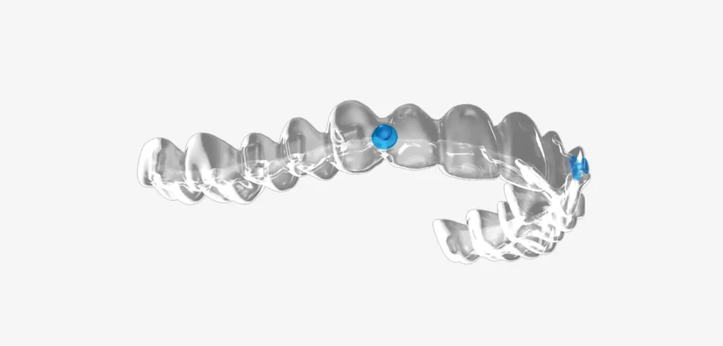 Angel Aligners at Elate Orthodontics Frisco TX