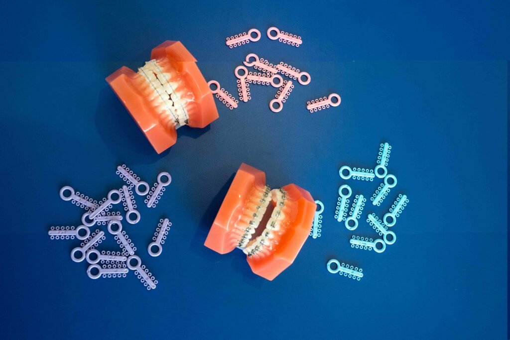 Traditional braces in Frisco TX at Elate Orthodontics
