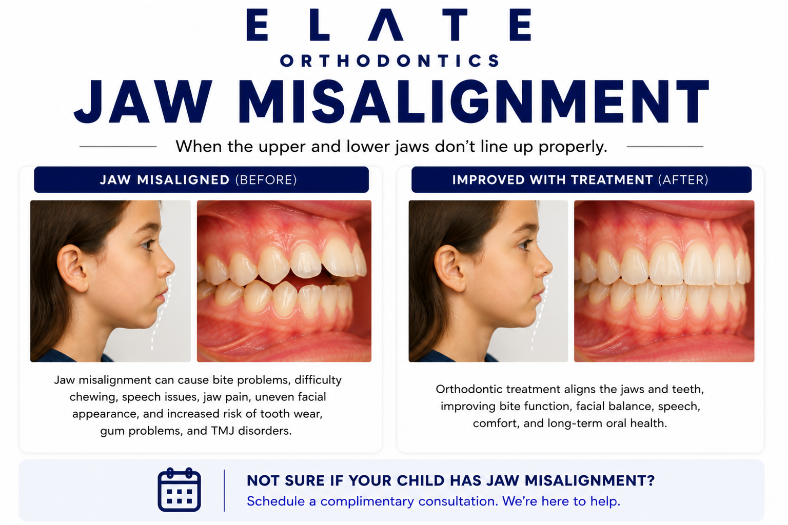 Jaw misalignment correction at Elate Orthodontics in Frisco and The Colony TX with growth modification orthognathic surgery coordination and comprehensive orthodontics